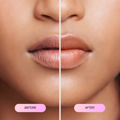 Collagen Lip Masks Before & After